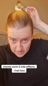 Chemo EC, Cycle 2 side effects