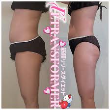 久留米市(福岡) × エステ・リラクサロン お得に予約するなら！｜ミニモ