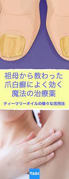 ティーツリーオイル 水虫 爪白癬 カビ ニキビケア 炎症 スキンケア 肌ケア 効果 花粉症 おすすめ 活用法 傷 治療薬 ココナッツオイル 掃除 洗剤 デオドラント 万能薬 ライフハック ちえとく セルフケア 殺菌 白癬 爪白癬 治療