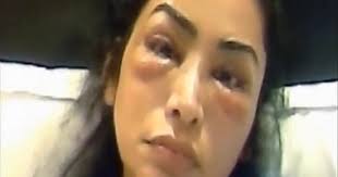 ( ليس البر أن تولوا وجوهكم قبل المشرق والمغرب ) يقول : Ø¹Ù…Ù„ÙŠØ© ØªØ¬Ù…ÙŠÙ„ ØªÙ†Ù‡Ù‰ Ù…Ø³ØªÙ‚Ø¨Ù„ Ø¹Ø§Ø±Ø¶Ø© Ø£Ø²ÙŠØ§Ø¡ Ø¨Ø¹Ø¯ ØªÙˆØ±Ù… Ø¹ÙŠÙ†ÙŠÙ‡Ø§ ÙˆØ§Ù„Ø³Ø¨Ø¨ Ø­Ù‚Ù† Ø§Ù„ÙÙŠÙ„Ø± Ø§Ù„ÙŠÙˆÙ… Ø§Ù„Ø³Ø§Ø¨Ø¹
