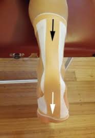 Image result for Taping for Soleus and Achilles