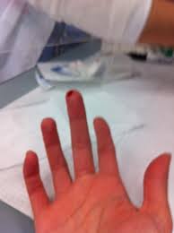 I have never found it to be painful. Giving Blood What To Expect 5 Benefits Of Donating