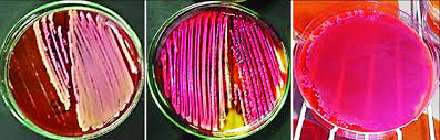 Ornithinolytica bacteremia occurs mainly in patients with underlying malignancies. Growth Of Raoultella Ornithinolytica Colonies On Xld Agar Download Scientific Diagram