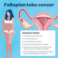 Common accompanying symptoms of a hard groin lump it's also likely to experience the following symptoms. What Is Gynaecological Cancer And What Are The Symptoms Queensland Health