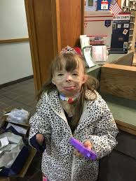 Finding christmas gifts for her can bring you incredible festive joy or make you want to drown your sorrows in mulled wine. Online Post Leads To Christmas Cards Gifts For 8 Year Old Girl Disfigured By Fire In New York News 1130