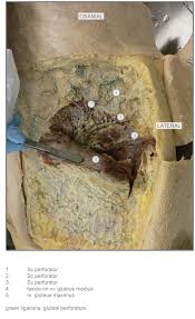 Cadaveric Dissection Musculus Gluteus Maximus Partly Detached From Its Download Scientific Diagram