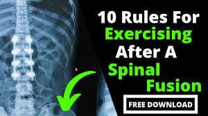 core exercises safe for spinal fusions