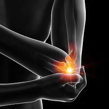 Image result for Coronoid Process Fracture