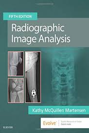 Radiographic Image Analysis By Kathy Mcquillen Martensen Ma Rt R Saunders Books To Read Online Analysis Image