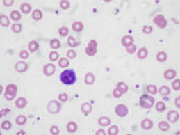 Image result for Peripheral Smear