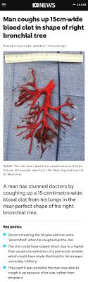 Less commonly, coughing up blood may be the result of: Man Coughs Up 15cm Wide Blood Clot In Shape Of Right Bronchial Tree Imgur