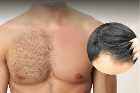 Maybe you would like to learn more about one of these? Body Hair Transplant In Turkey Bht Aek Hair Clinic