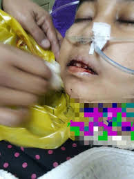 Tahukah anda, limfoma boleh dirawat jika dapat dikesan pada peringkat awal dan dapatkan pemeriksaan doktor kerana jika. 20663973 928021054021591 9071612728666060829 N Mingguan Wanita