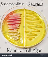 Image result for Staphylococcus Saprophyticus