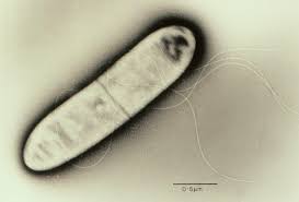Learn and reinforce your understanding of listeria monocytogenes through video. Closing Gaps For Listeria Risk Assessment In Ready To Eat Foods