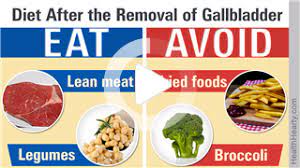 Post Gallbladder Removal Diet In 2021 Galbladder Diet Gallbladder Removal Diet Gallbladder Diet