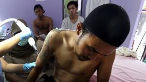 While the epiphany project teaches important life skills and coping mechanisms, the tattoo removal program assists former gang members in transforming their lives by removing tattoos; Memorize Qur An Chapter Get Free Tattoo Removal About Islam