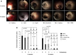 Diversion colitis is likely caused by a deficiency of scfa, which serve as lumenal nutrients for colonocytes as earlier studies showed beneficial effects of scfa on diversion colitis. Ascidian Chordate Tunicate And Mammalian Heparin Enemas Attenuate Experimental Diversion Colitis Surgery