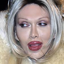 Pete Burns, frontman of Dead Or Alive, dies aged 57