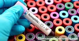 Bij een bloeding wordt daardoor een bloedklonter gevormd die minder stabiel is. 10 Symptomen Van Hemofilie Over De Gezondheid 2021