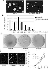GAREM, a Novel Adaptor Protein for Growth Factor Receptor-bound Protein 2,  Contributes to Cellular Transformation through the Ac