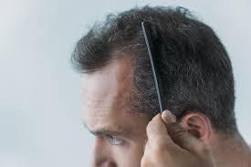 Some affect men, and others affect women. Habits That Cause Hair Loss Az Hair Restoration