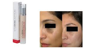 If you'd asked me before this for a recommendation, the clinique even better was the only whitening serum i'd recommend. Clinique Even Better Clinical Dark Spot Corrector Picshealth