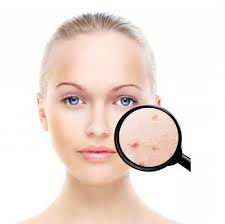 Ada banyak obat batuk yang aman untuk ibu hamil, yang juga alami dan efektif untuk meredakan batuk saat hamil. Jerawat Di Muka Semasa Mengandung Punca Dan Rawatan Mungkin Bolehkah Saya Memerah Jerawat Di Muka Anda