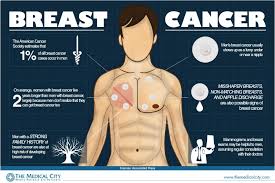 Most men who get breast cancer are over 60, although younger men can be affected. Male Breast Cancer Infographic Bloemfontein Courant