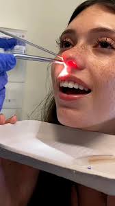 You Won't Believe What's In Her Nose