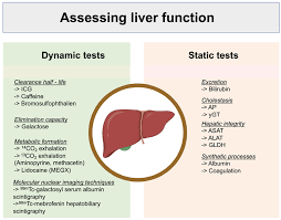 Image result for Liver Function Test