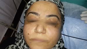 Ben Aldırma Sonrası İz Kalır mı?