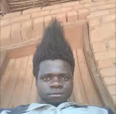 Has anyone else had blurry vision issues?