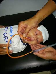 Buat posisi bayi telentang namun perut tetap santai. Ubat Buang Kahak Jurupulih N