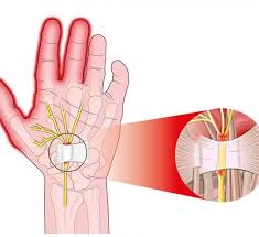 Arquivos Noticias Uniort Clinica De Ortopedia E Traumatologia