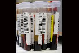 Prostate cancer is a common type of cancer in men, according to the mayo clinic. Prostate Cancer Diagnosis And Staging