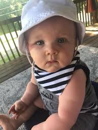 Sturge Weber Syndrome Awareness Day