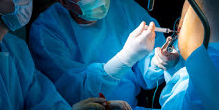 Hemorrhoid Surgery Options: Exploring Surgical Procedures For Severe Cases