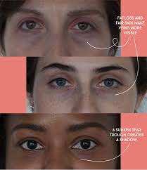 Like you, most people think that a good night's wash off the next morning with cold water. Puffy Eyes Dark Circles And Bags Dermatologists Explain The Difference Self