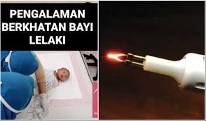 Penjagaan luka selepas bersunat dengan laser dr. Ibu Kongsi Pengalaman Sebelum Semasa Selepas Berkhatan Bayi Lelaki Guna Teknik Laser
