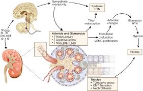 Image result for Hyperuricemia