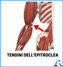 Come Vincere La Battaglia Contro L Epitrocleite Esperienza Personale Guida Completa L Altra Riabilitazione