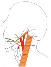 A person with neck swelling has enlargement of the soft tissues that covers the neck. Unusual Origin Of The Arteries In The Carotid Triangle Of The Neck A Case Report And Literature Review