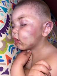 This little boy approximately 2 years old was found last night walking  behind a home here in #statenisland Deputy Tyler Cooper saved him and took  him to the Police Station but no