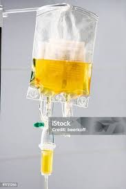 Image result for Plasma Transfusion