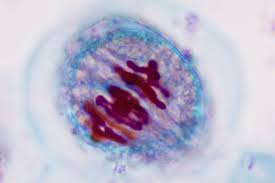 Pairs of chromosomes are lined up at the center of the cell and then pulled to each side. Overview Of The Stages Of Meiosis