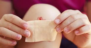 For further information on this topic, please refer to the wound, ostomy, continence nurses society (wocn.org) for their Cuts And Scrapes In Children First Aid