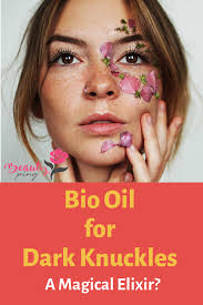 Bio Oil Before After Why Not Try Bio Oil For Your Dark Knuckles The Product Has Been Shown To Have Natural Skin Light Essential Oils For Skin Oils For Skin Natural Skin Lightening
