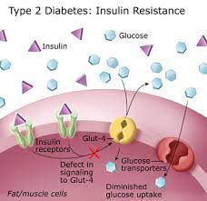 Type 2 diabetes affects more than 29 million americans. What Is Type 2 Diabetes Diabetes Education Online