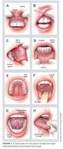 Image result for gum cancer symptoms